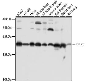 Western Blot - Anti-RPL26 Antibody (A88725) - Antibodies.com