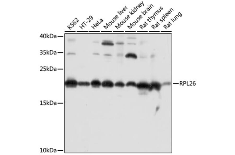 Western Blot - Anti-RPL26 Antibody (A88725) - Antibodies.com