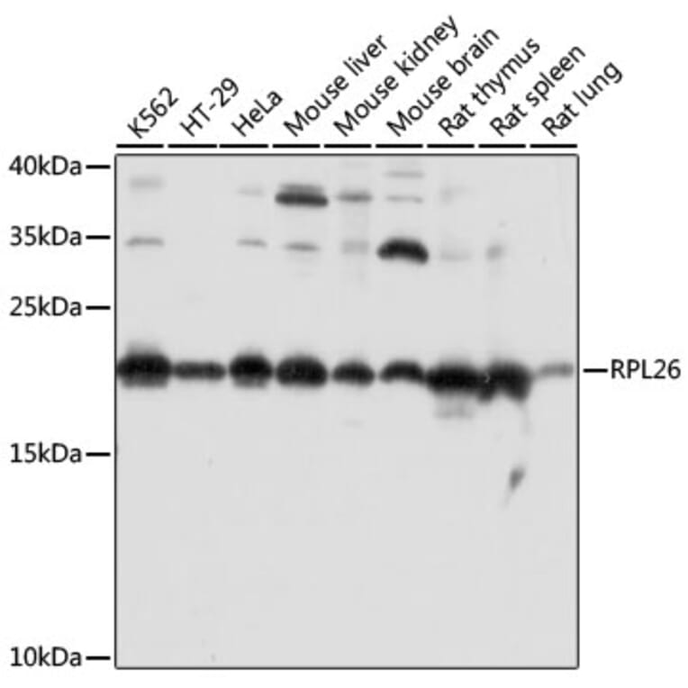 Western Blot - Anti-RPL26 Antibody (A88725) - Antibodies.com