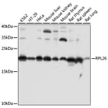 Western Blot - Anti-RPL26 Antibody (A88725) - Antibodies.com