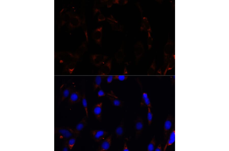 Immunofluorescence - Anti-RPL26 Antibody (A88725) - Antibodies.com