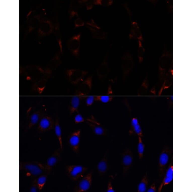 Immunofluorescence - Anti-RPL26 Antibody (A88725) - Antibodies.com