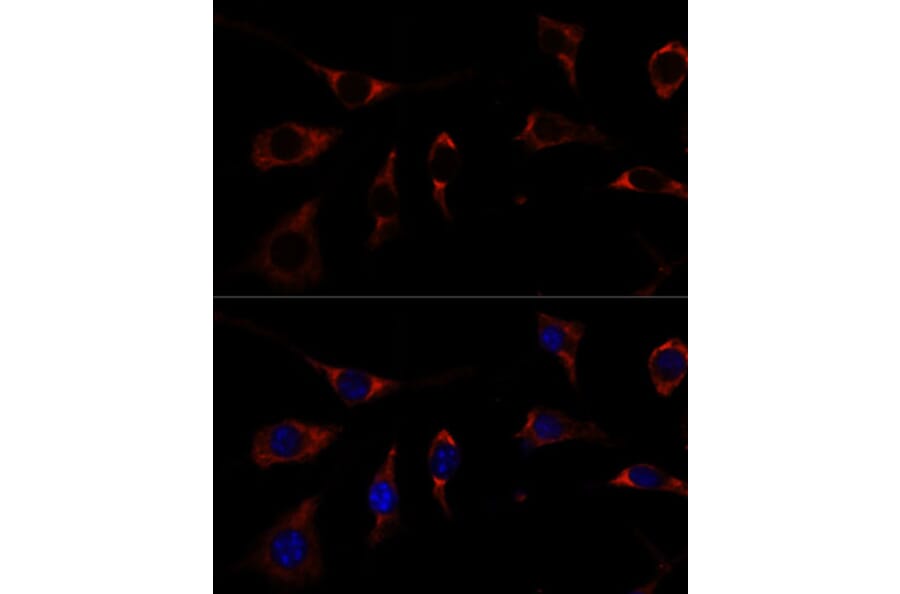 Immunofluorescence - Anti-RPL26 Antibody (A88725) - Antibodies.com