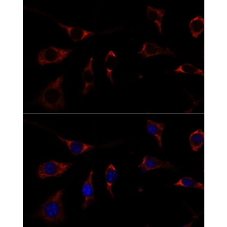 Immunofluorescence - Anti-RPL26 Antibody (A88725) - Antibodies.com