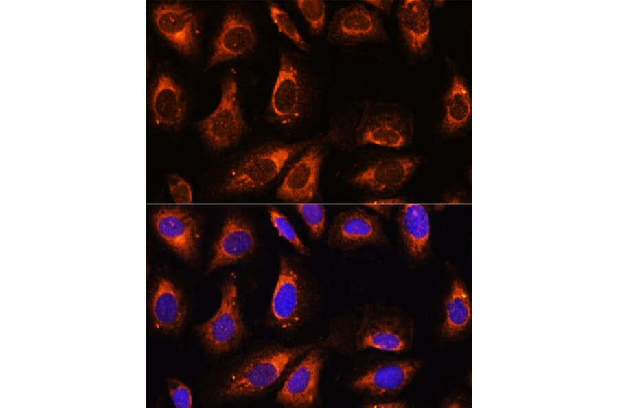 Immunofluorescence - Anti-RPL26 Antibody (A88725) - Antibodies.com