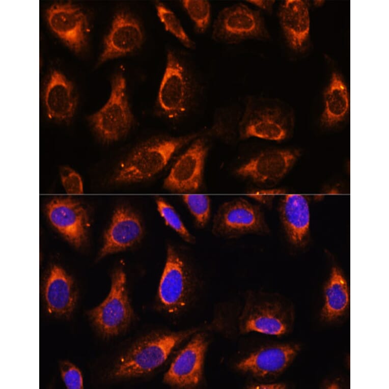 Immunofluorescence - Anti-RPL26 Antibody (A88725) - Antibodies.com