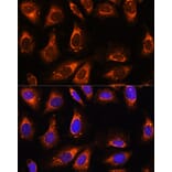 Immunofluorescence - Anti-RPL26 Antibody (A88725) - Antibodies.com