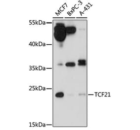 Western Blot - Anti-TCF21 Antibody (A88726) - Antibodies.com