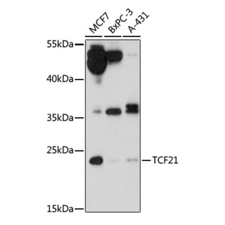 Western Blot - Anti-TCF21 Antibody (A88726) - Antibodies.com