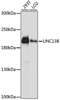 Western blot analysis of extracts of various cell lines, using Anti-UNC13B Antibody (A15780) at 1:1,000 dilution.
Secondary antibody: Goat Anti-Rabbit IgG (H+L) (HRP) (AS014) at 1:10,000 dilution.
Lysates / proteins: 25µg per lane.
Blocking buffer: 3% non-fat dry milk in TBST.
Detection: ECL Basic Kit (RM00020).
Exposure time: 10s.
