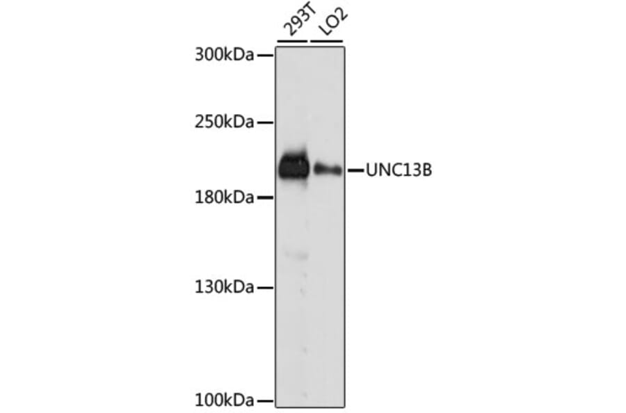 Western Blot - Anti-UNC13B Antibody (A88729) - Antibodies.com