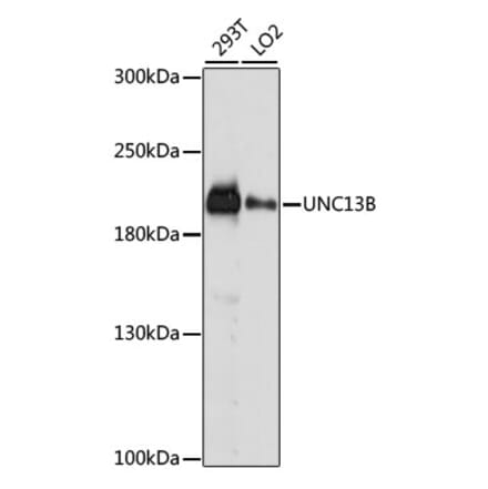 Western Blot - Anti-UNC13B Antibody (A88729) - Antibodies.com