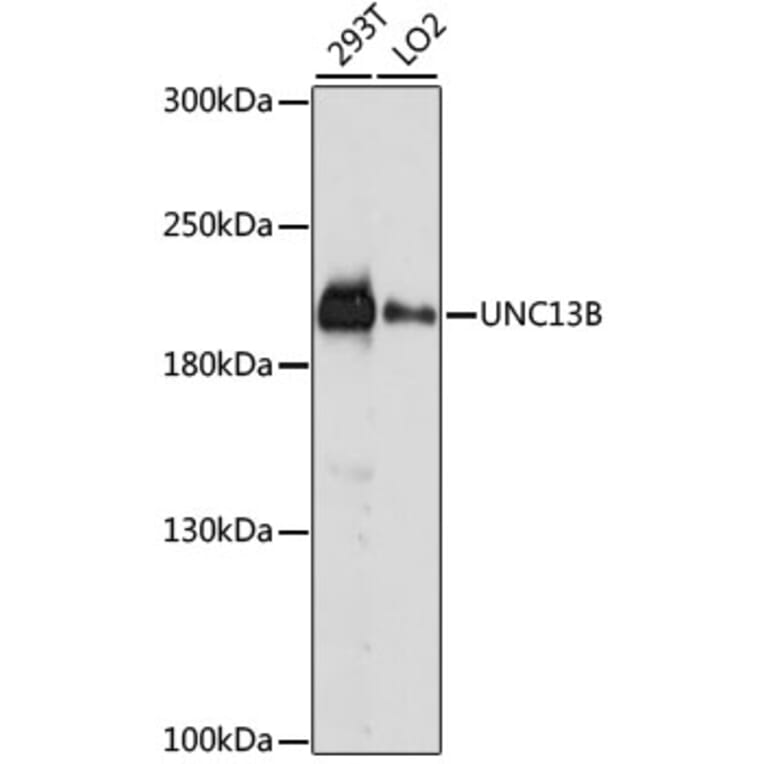 Western Blot - Anti-UNC13B Antibody (A88729) - Antibodies.com