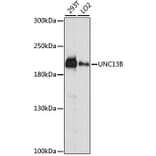 Western Blot - Anti-UNC13B Antibody (A88729) - Antibodies.com