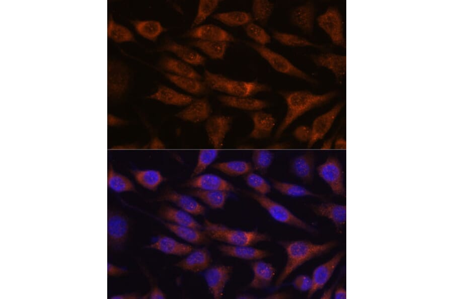 Immunofluorescence - Anti-UNC13B Antibody (A88729) - Antibodies.com