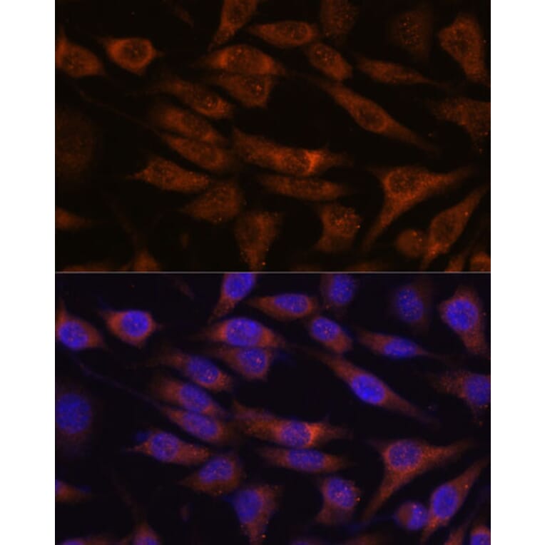 Immunofluorescence - Anti-UNC13B Antibody (A88729) - Antibodies.com