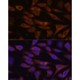 Immunofluorescence - Anti-UNC13B Antibody (A88729) - Antibodies.com