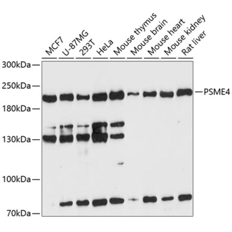 Western Blot - Anti-Proteasome Activator Subunit 4/PSME4 Antibody (A88730) - Antibodies.com