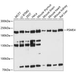 Western Blot - Anti-Proteasome Activator Subunit 4/PSME4 Antibody (A88730) - Antibodies.com