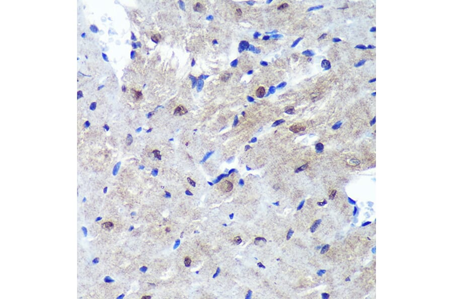 Immunohistochemistry - Anti-Proteasome Activator Subunit 4/PSME4 Antibody (A88730) - Antibodies.com