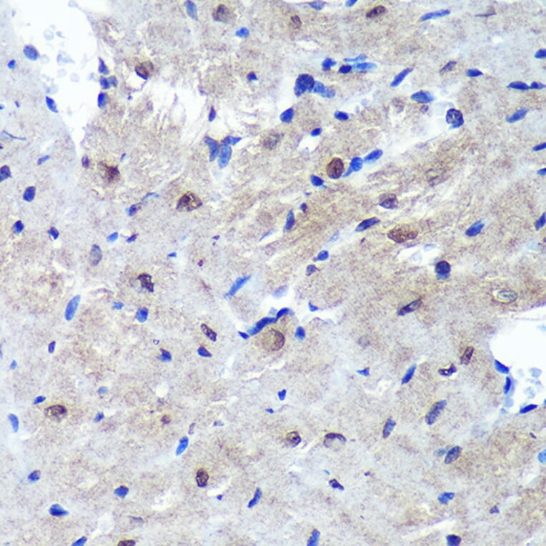 Immunohistochemistry - Anti-Proteasome Activator Subunit 4/PSME4 Antibody (A88730) - Antibodies.com