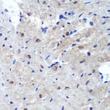 Immunohistochemistry - Anti-Proteasome Activator Subunit 4/PSME4 Antibody (A88730) - Antibodies.com