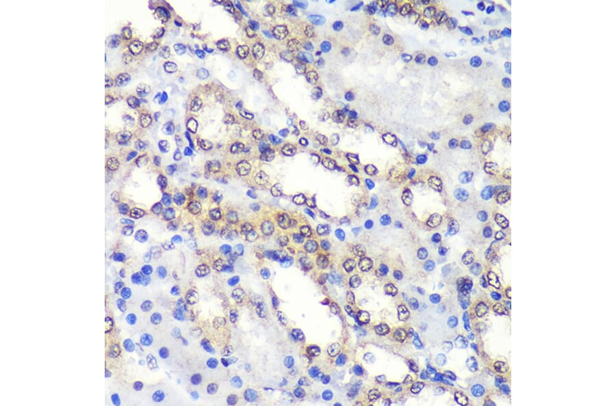 Immunohistochemistry - Anti-Proteasome Activator Subunit 4/PSME4 Antibody (A88730) - Antibodies.com