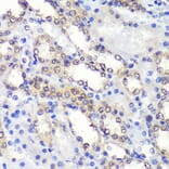 Immunohistochemistry - Anti-Proteasome Activator Subunit 4/PSME4 Antibody (A88730) - Antibodies.com
