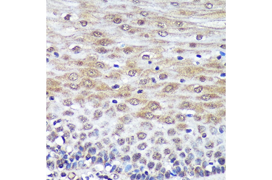 Immunohistochemistry - Anti-Proteasome Activator Subunit 4/PSME4 Antibody (A88730) - Antibodies.com