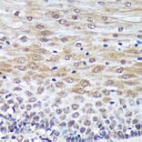 Immunohistochemistry - Anti-Proteasome Activator Subunit 4/PSME4 Antibody (A88730) - Antibodies.com