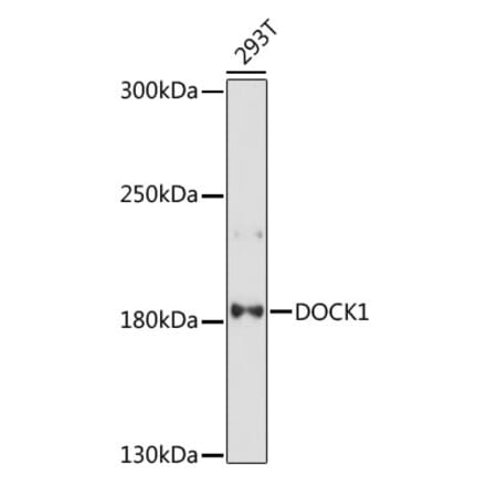 Western Blot - Anti-DOCK1 Antibody (A88732) - Antibodies.com
