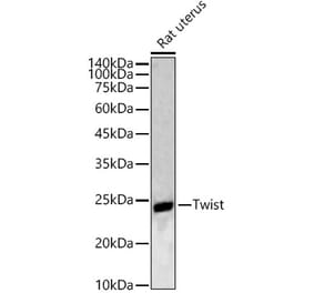 Western Blot - Anti-Twist Antibody (A88733) - Antibodies.com