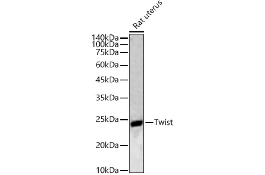 Western Blot - Anti-Twist Antibody (A88733) - Antibodies.com