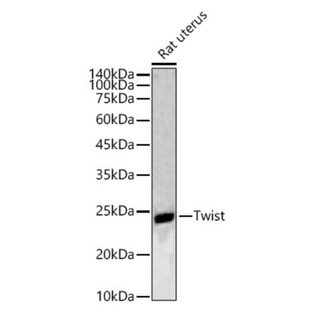 Western Blot - Anti-Twist Antibody (A88733) - Antibodies.com