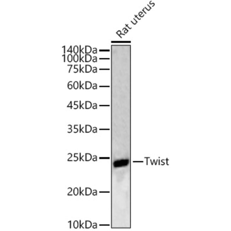 Western Blot - Anti-Twist Antibody (A88733) - Antibodies.com