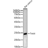 Western Blot - Anti-Twist Antibody (A88733) - Antibodies.com