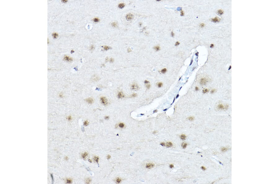 Immunohistochemistry - Anti-Twist Antibody (A88733) - Antibodies.com
