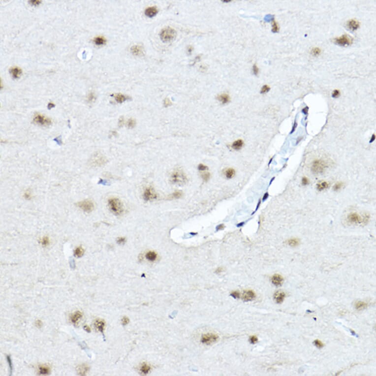 Immunohistochemistry - Anti-Twist Antibody (A88733) - Antibodies.com