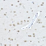 Immunohistochemistry - Anti-Twist Antibody (A88733) - Antibodies.com