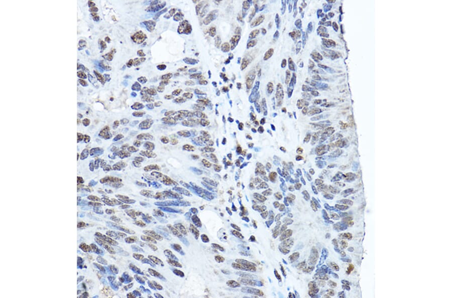 Immunohistochemistry - Anti-Twist Antibody (A88733) - Antibodies.com