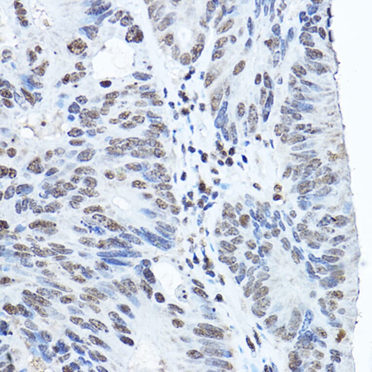 Immunohistochemistry - Anti-Twist Antibody (A88733) - Antibodies.com
