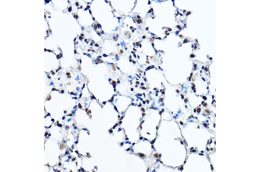 Immunohistochemistry - Anti-Twist Antibody (A88733) - Antibodies.com