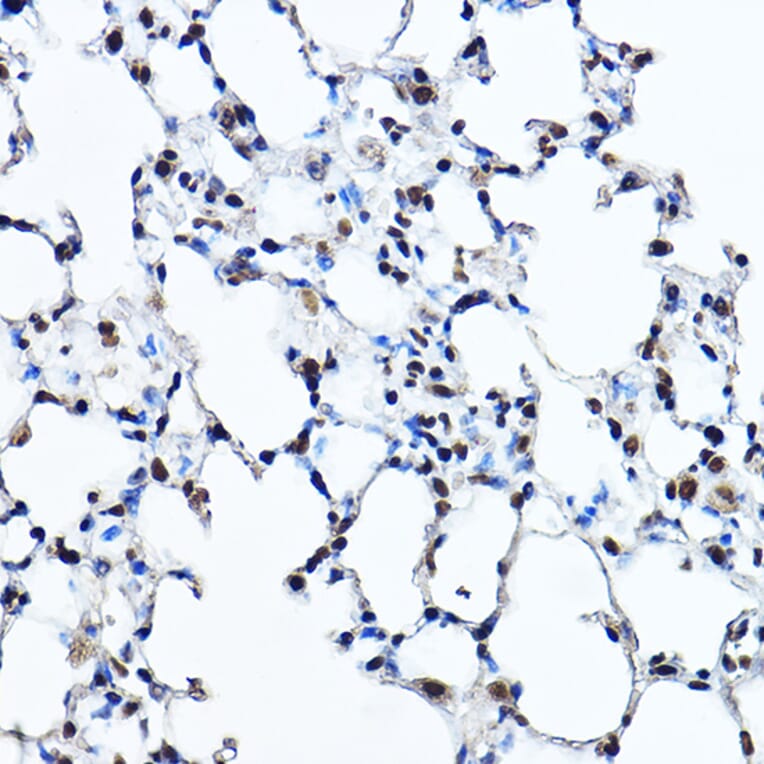 Immunohistochemistry - Anti-Twist Antibody (A88733) - Antibodies.com