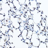 Immunohistochemistry - Anti-Twist Antibody (A88733) - Antibodies.com