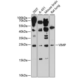 Western Blot - Anti-SELS Antibody (A88734) - Antibodies.com