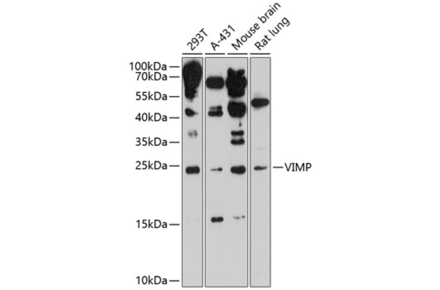 Western Blot - Anti-SELS Antibody (A88734) - Antibodies.com