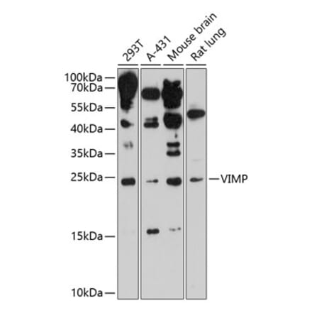Western Blot - Anti-SELS Antibody (A88734) - Antibodies.com