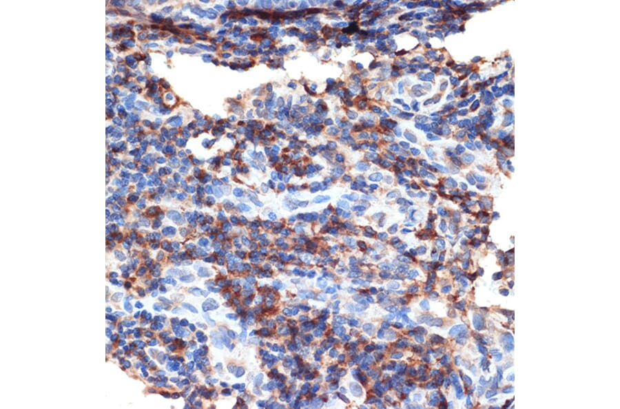 Immunohistochemistry - Anti-Bax Antibody (A88735) - Antibodies.com