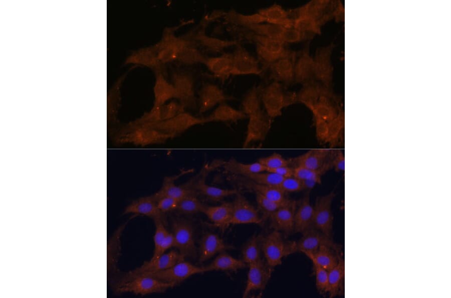 Immunofluorescence - Anti-Bax Antibody (A88735) - Antibodies.com