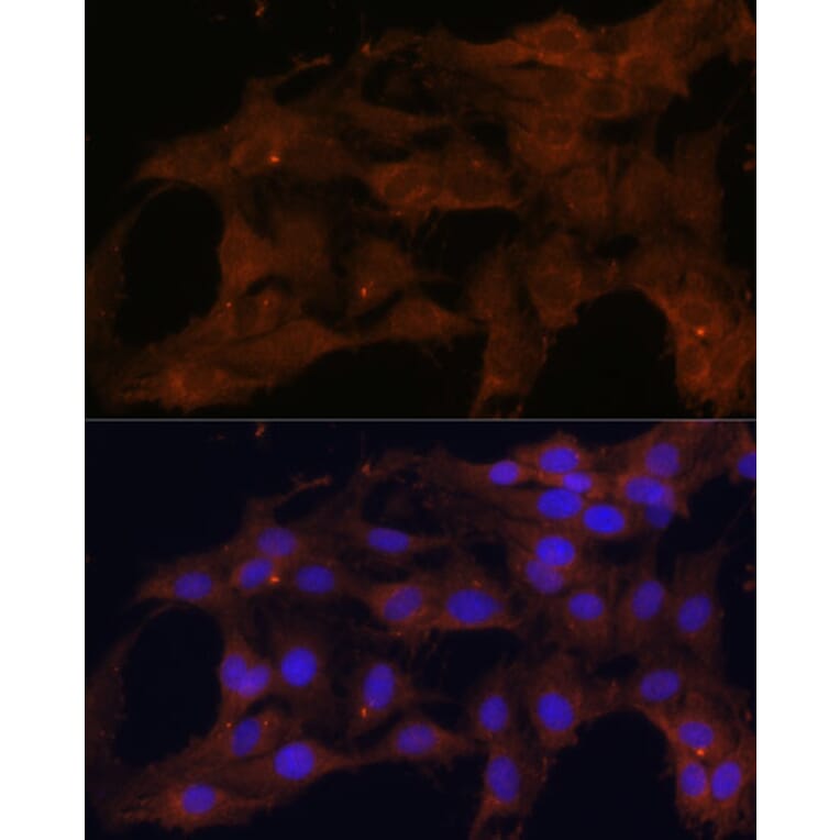 Immunofluorescence - Anti-Bax Antibody (A88735) - Antibodies.com